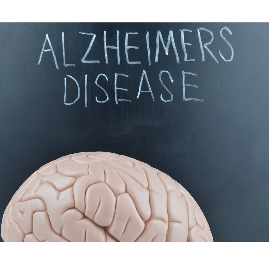 the stages of alzheimer's disease