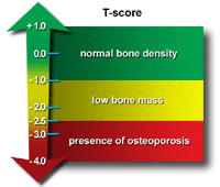 bone density 